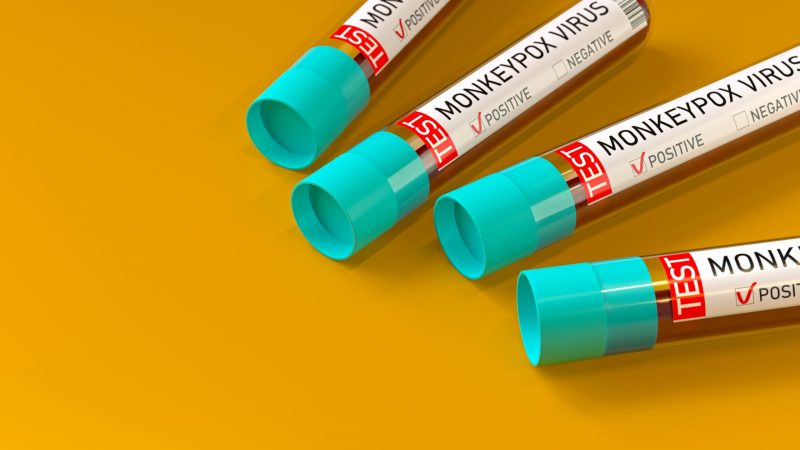 Monkeypox virus test tubes. 3D Rendering